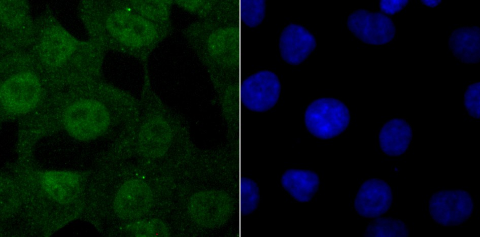 Anti-USP11 Antibody (1W222)