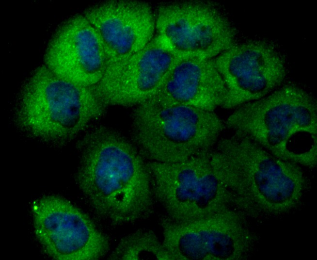 Anti-USP14 Antibody (2A615)