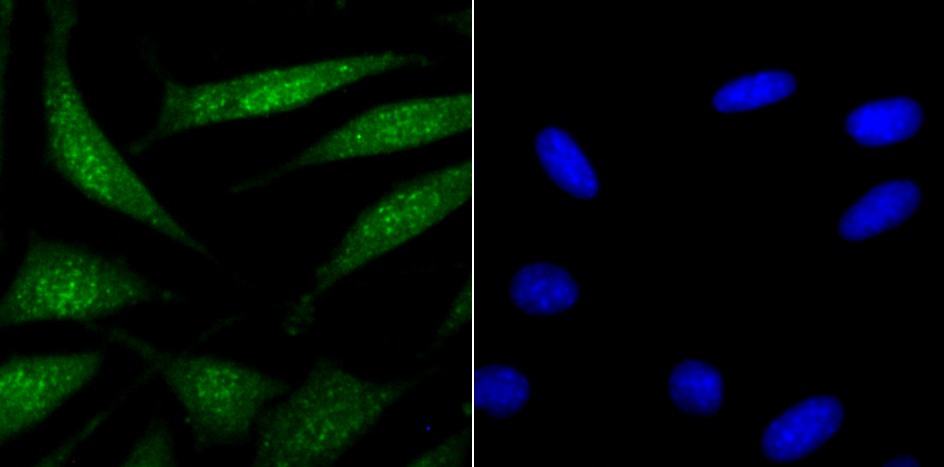 Anti-USP22 Antibody (1F346)