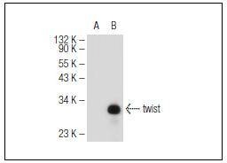 Anti-Twist Antibody (5E952)