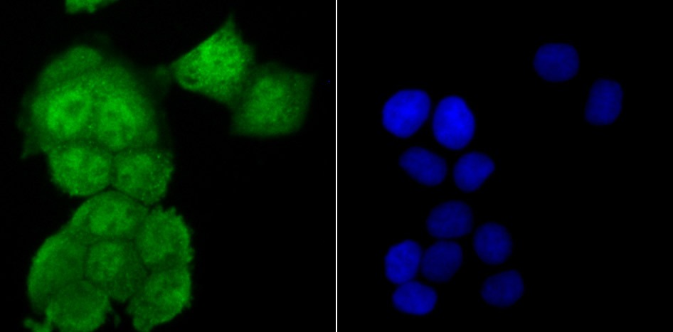 Anti-USP13 Antibody (7A655)