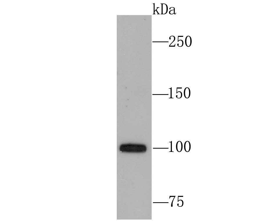 Anti-USP11 Antibody (1W222)