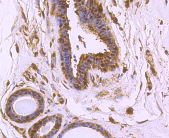 Anti-VCP Antibody (3I403)