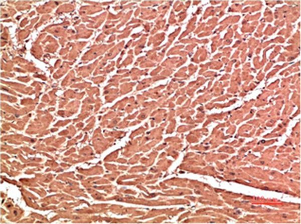 Anti-VE-Cadherin Antibody (2L788)