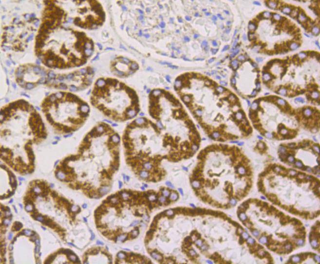 Anti-VDAC1 Antibody (9P313)