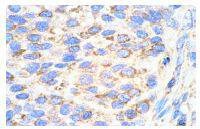 Anti-VEGFR2/KDR Antibody (5J724)