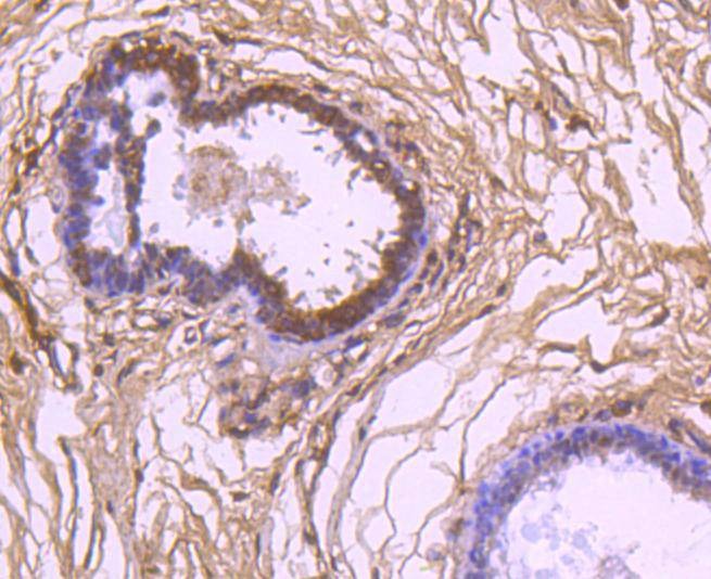 Anti-VEGFA Antibody (8D813)