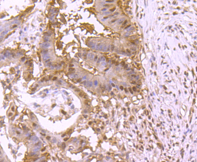 Anti-VCP Antibody (3I403)