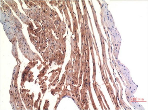 Anti-VE-Cadherin Antibody (2Q629)