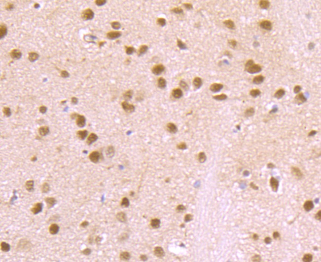 Anti-VCP Antibody (3I403)