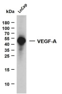 Anti-VEGFA Antibody (9D606)