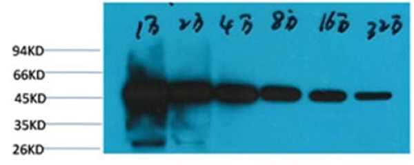 Anti-TUBB Antibody (2B457)
