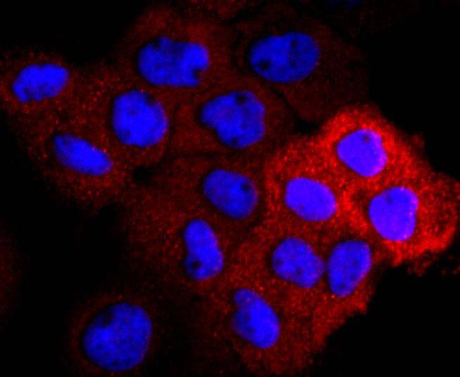 Anti-VEGFR2/KDR Antibody (1S897)