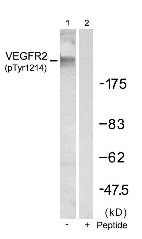 Anti-Phospho-VEGFR2/KDR (Tyr1214) Polyclonal Antibody