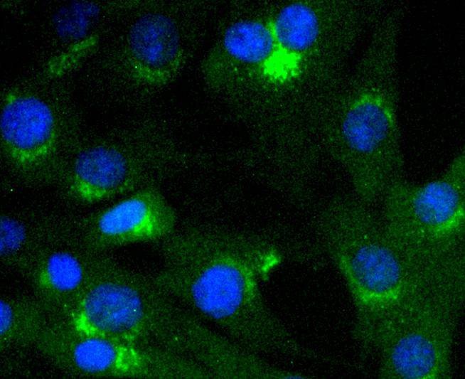 Anti-Vav2 Antibody (1D552)