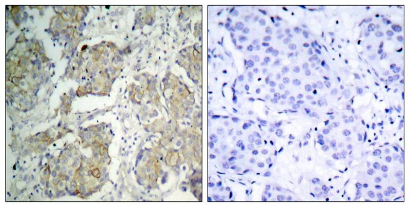 Anti-Phospho-VEGFR2/KDR (Tyr1214) Polyclonal Antibody