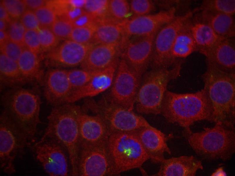 Anti-Phospho-VEGFR2/KDR (Tyr951) Polyclonal Antibody