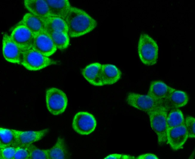 Anti-villin1 Antibody (7N900)