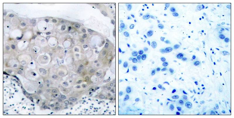 Anti-Phospho-VEGFR2/KDR (Tyr951) Polyclonal Antibody