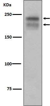 Anti-VEGFR2/KDR Antibody (1S897)