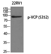 Anti-Phospho-VCP (Ser352) Polyclonal Antibody