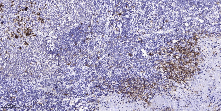 Anti-Phospho-VHL (Ser68) Polyclonal Antibody