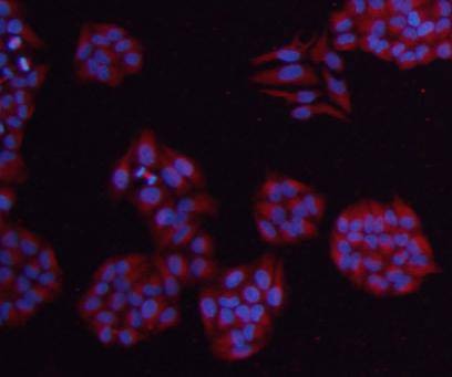 Anti-TUBB Antibody (8X869)