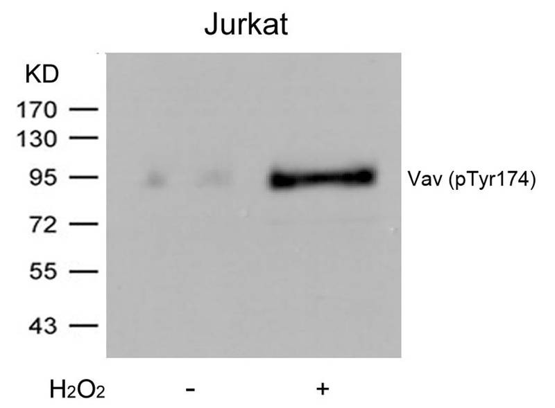 Anti-Phospho-Vav (Tyr174) Polyclonal Antibody