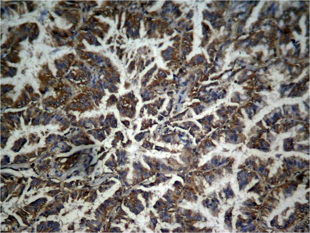 Anti-Phospho-CTNNB1 (Tyr333) Polyclonal Antibody