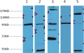Anti-CTNNB1 Antibody (3Q677)