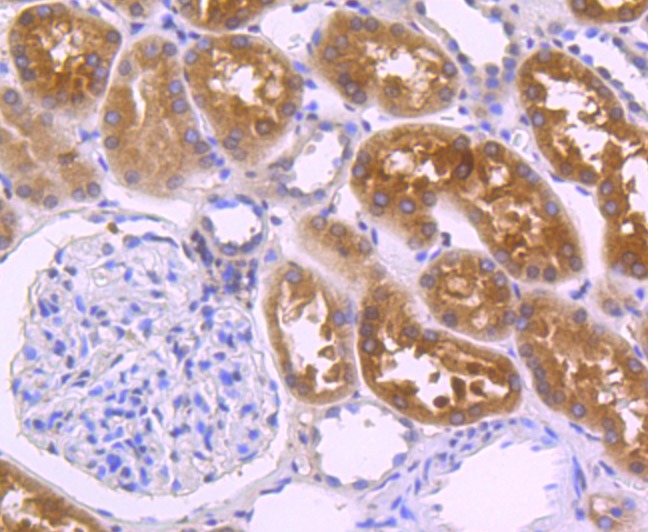 Anti-villin1 Antibody (7N900)