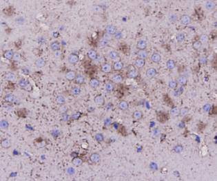 Anti-TUBB Antibody (8X869)