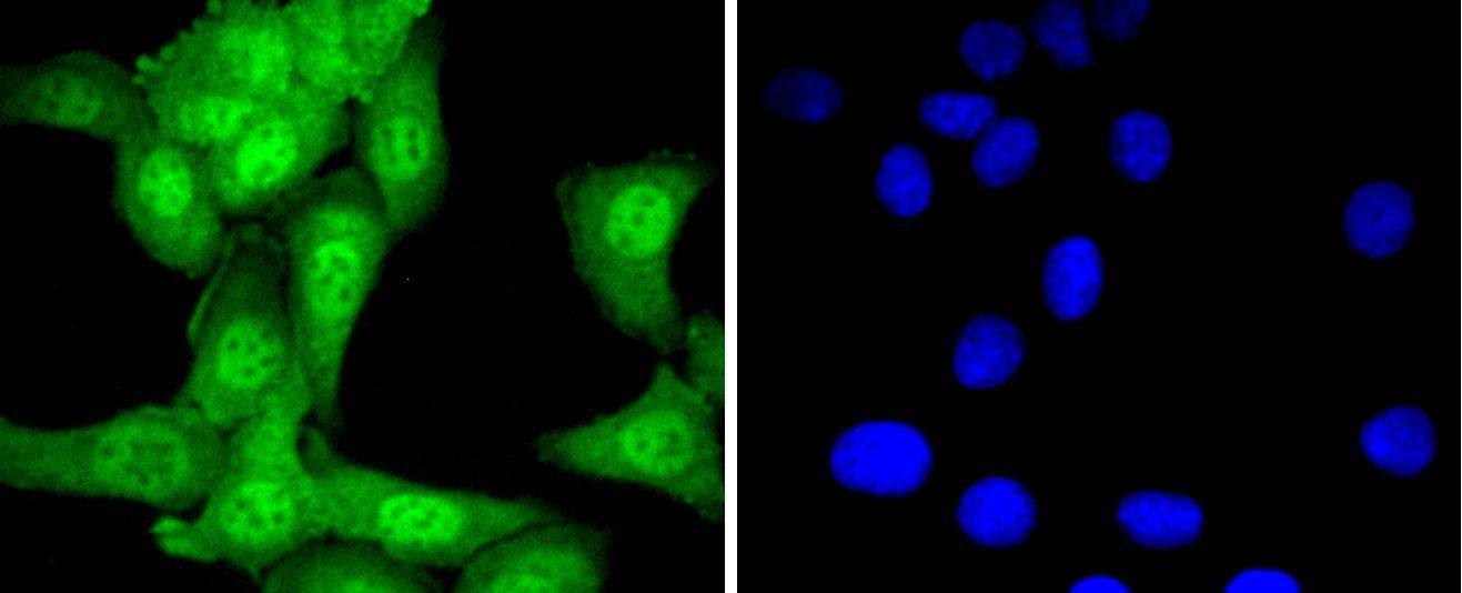 Anti-Ubiquitin Activating Enzyme E1/UBA1 Antibody (1V154)