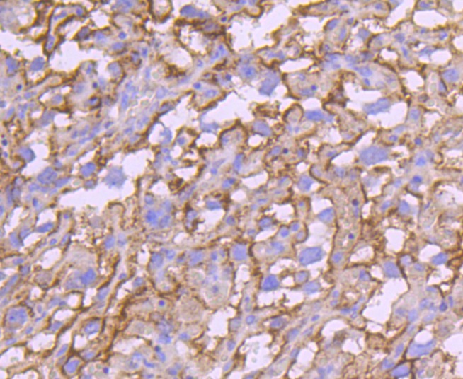 Anti-Transferrin Receptor/TFRC Antibody (4M349)