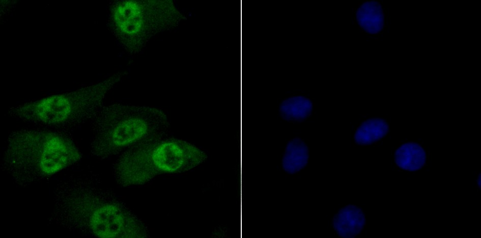Anti-TNPO3 Antibody (8G85)