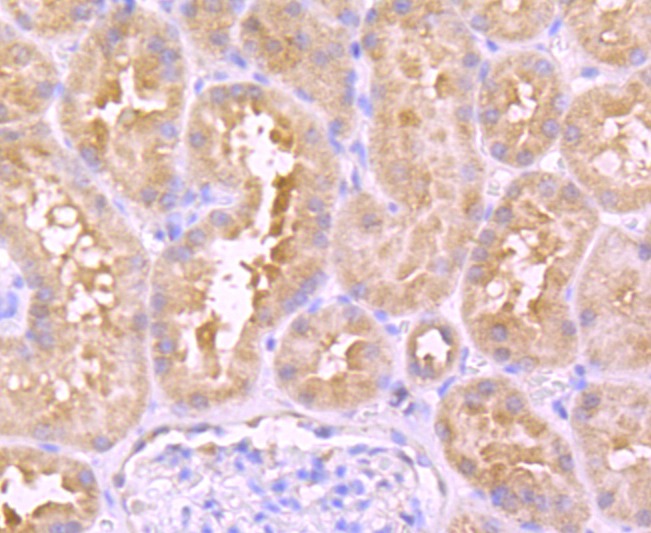 Anti-PLAU/uPA Antibody (8V289)