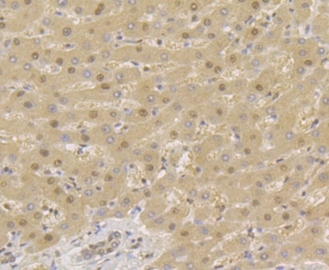 Anti-TNPO3 Antibody (8G85)