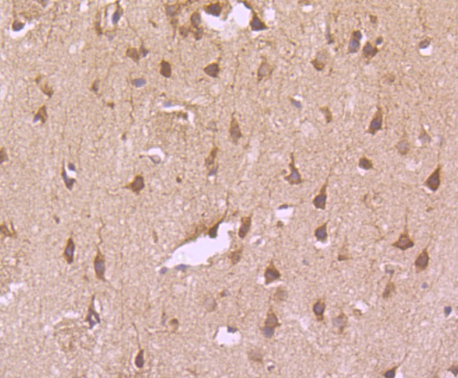 Anti-Transferrin Receptor/TFRC Antibody (4M349)