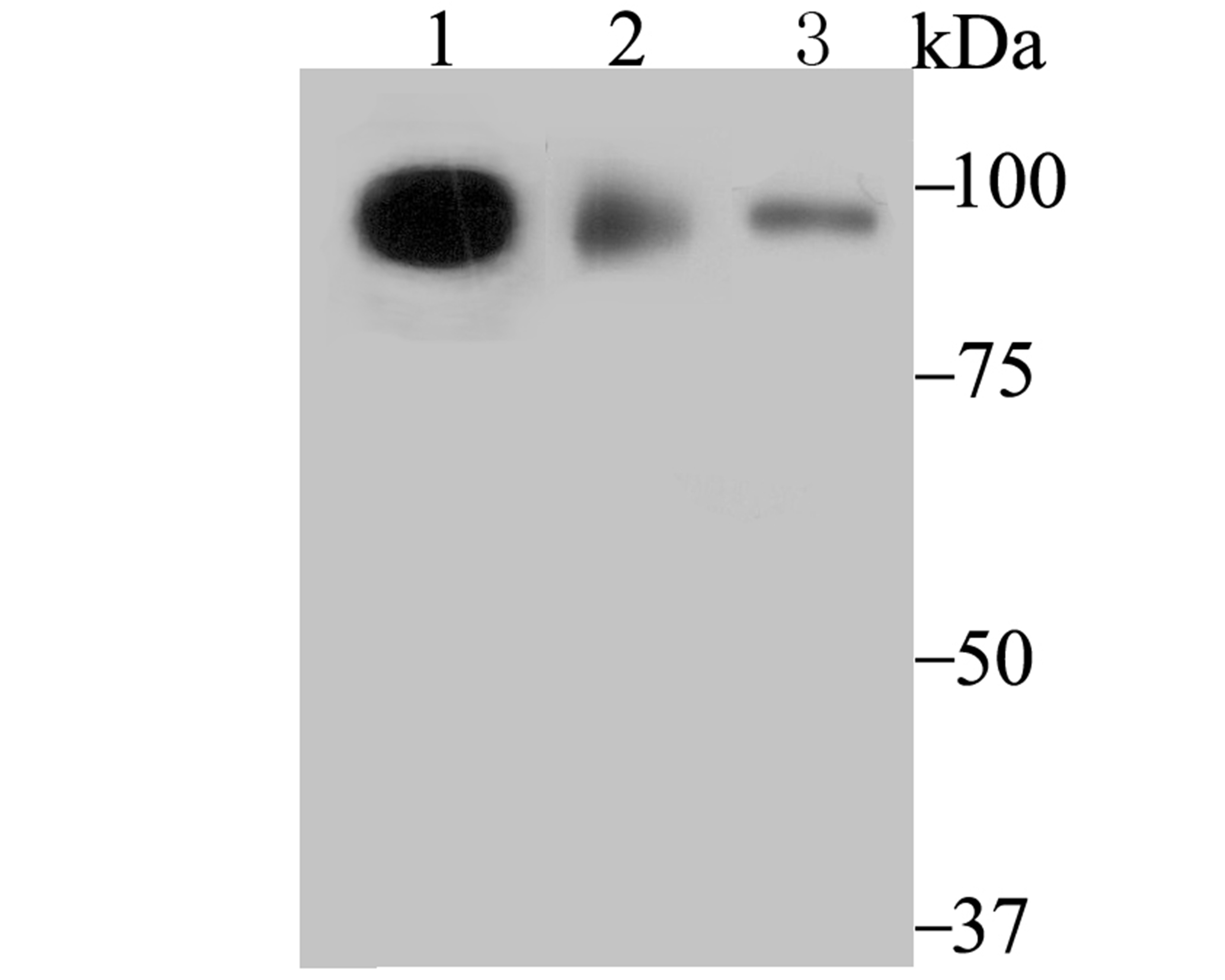 Anti-TNPO3 Antibody (8G85)