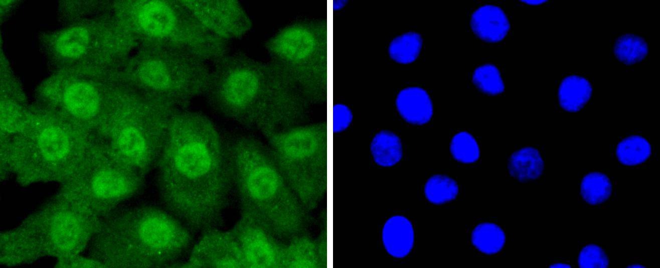Anti-Ubiquitin Activating Enzyme E1/UBA1 Antibody (1V154)