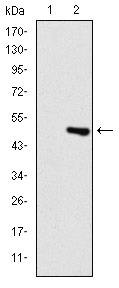 Anti-TNNI2 Antibody (1Z708)