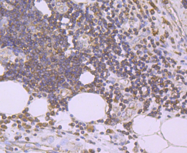 Anti-PLAU/uPA Antibody (8V289)