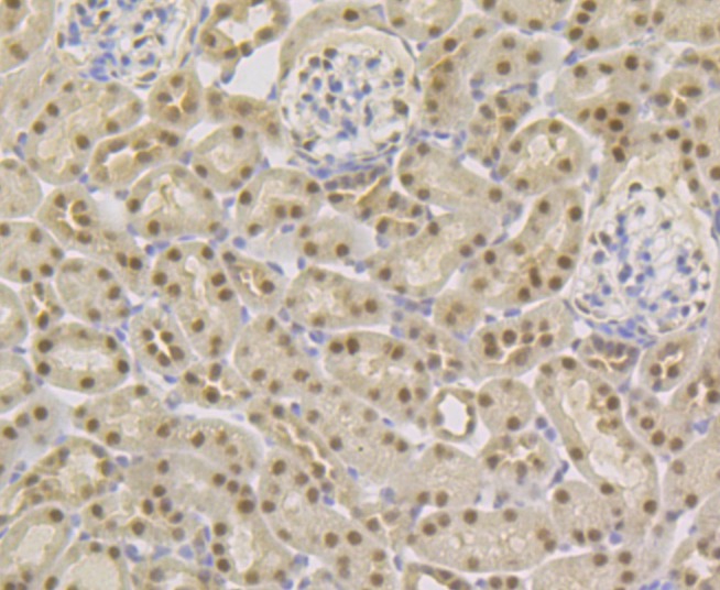 Anti-TNPO3 Antibody (8G85)
