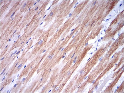 Anti-TNNI2 Antibody (1Z708)