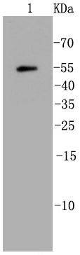 Anti-UBB Antibody (3A357)