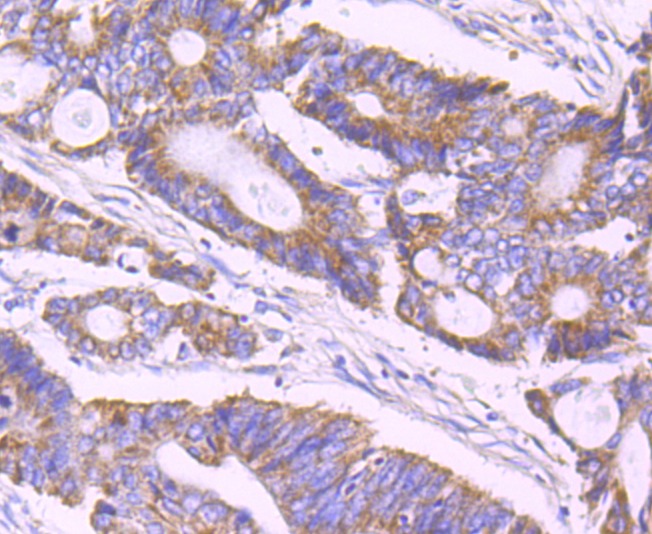 Anti-ULK1 Antibody (6P282)