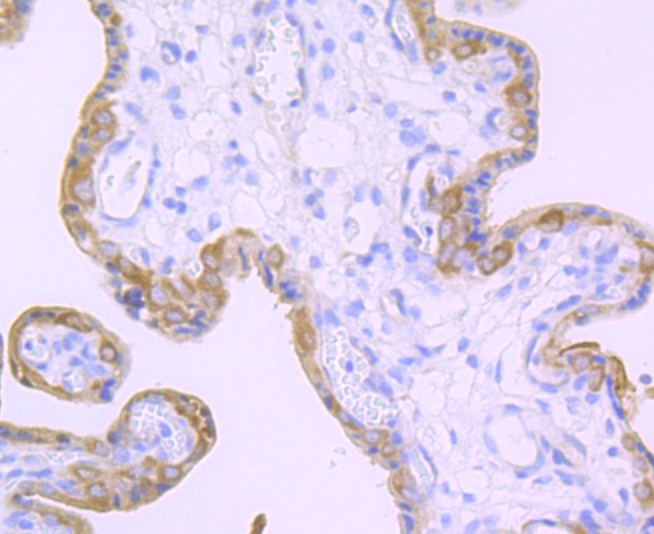 Anti-TGM2 Antibody (9X389)
