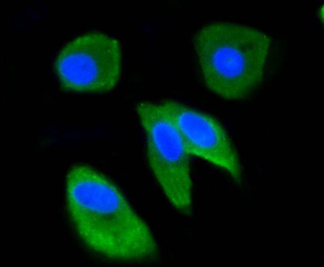 Anti-UBB Antibody (3A357)