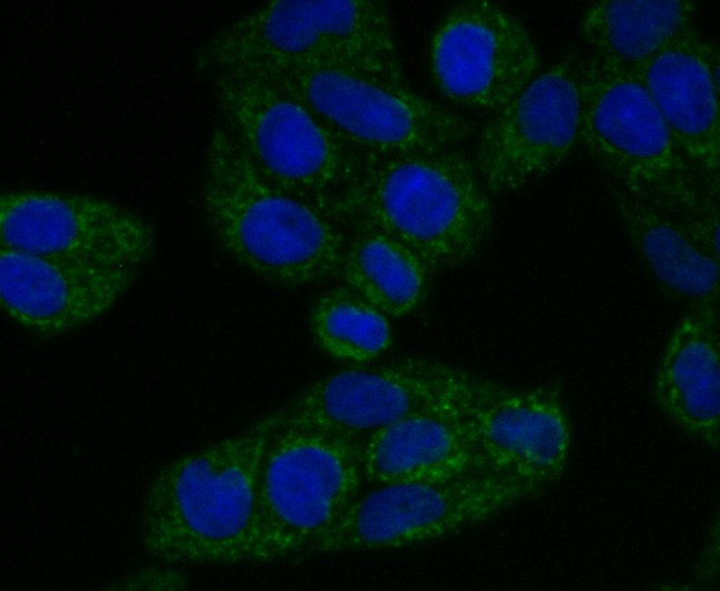 Anti-TREX1 Antibody (9A314)