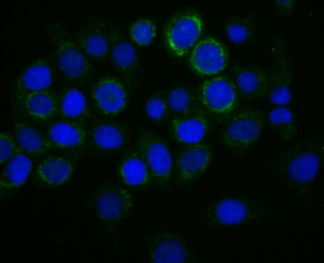 Anti-TREX1 Antibody (9A314)
